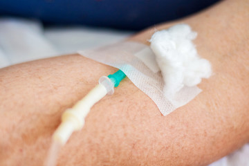 Intravenous drug administration in the clinic. Treatment with a dropper_