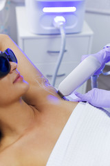 Epilation wiith diod laser