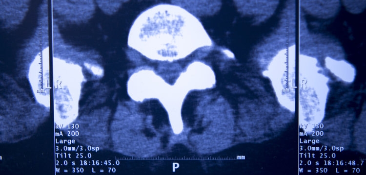 Medical hips spine pelvis MRI scan