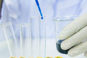 Close up. Medical or male medical in laboratory room research performs tests with blue liquid, Experimental Drug Treatment