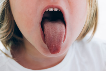 a child girl open her mouth and show her tounge