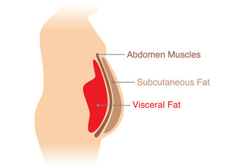 Location of Visceral fat stored within the abdominal cavity. Illustration about medical diagram.