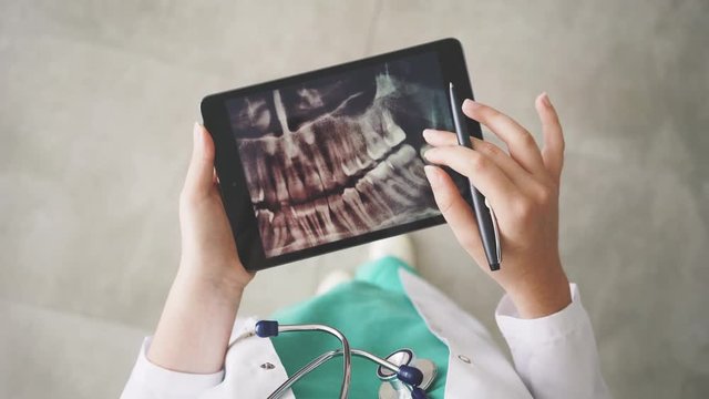Doctor looking at teeth X-ray on digital tablet