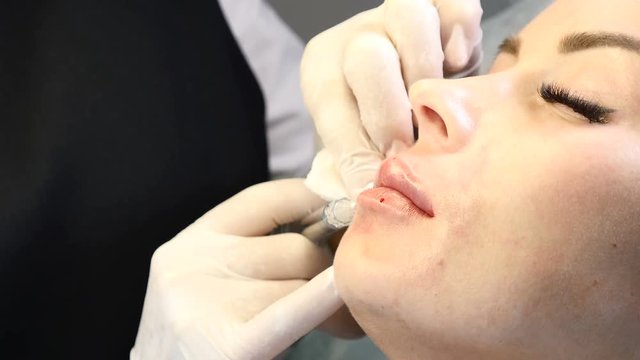 Face care concept. Injections into lips. Cosmetologist in gloves making lifting procedure with syringe. 4k