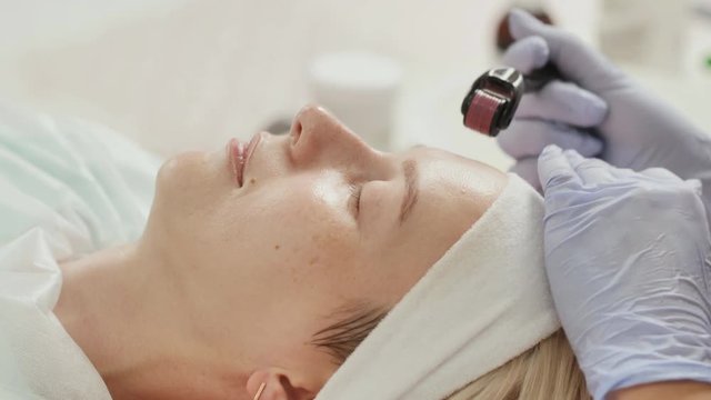 Close-up portrait of woman having beauty skin treatment. Therapist preparing skin with derma roller.