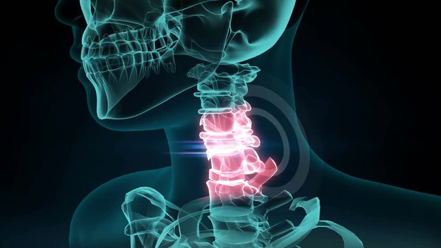 3d rendered illustration of a painful neck joint. medical concept, 4k animation.