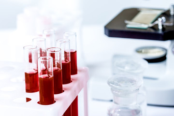 blood in glass tubes on background of microscope