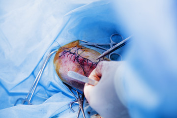 Dog in the animal hospital. Canine during surgery. (Health, animal, hospital, treatment, medicine...