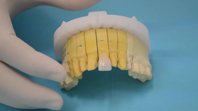 Preparation for dental crown