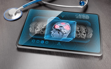 Medical tablet displaying scan of brain activity