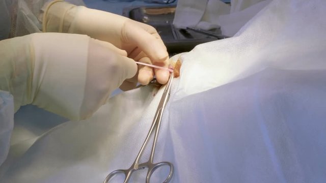 The procedure of castration. Veterinary surgeon operating a cat in a veterinary clinic. 4K