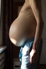 ascites in a person standing near a window