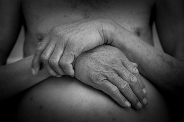 ascites in man, holds his belly with his own hands