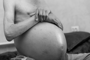 ascites in man, holds his belly with his own hands