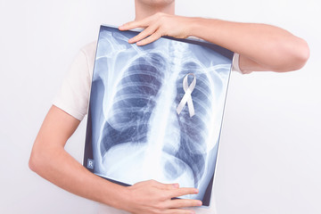 Oncological lung cancer disease concept. Guy male man holding medical lung body x-ray photo with...