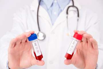 AIDS / HIV disease concept. Doctor wearing white coat blue rubber medical gloves with pinned red...