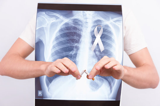 Oncological disease concept. Guy male man holding medical lung body x-ray photo with pinned white ribbon as a symbol of lung cancer and braking cigarette on white isolated background