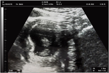 An ultrasound of a mother fetus during the 08th week background as Medical and Health of the baby concept. vector illustration..