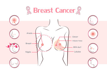 woman with breast cancer symptom