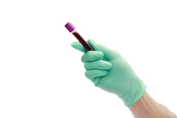 Hand with latex glove holding blood sample
