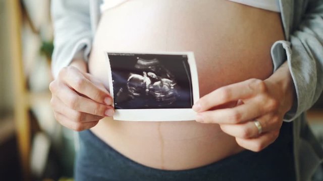 Close-up shot of big pregnant tummy and woman's hands holding sonogram image of healthy unborn baby. Pregnancy, women's health and people concept.