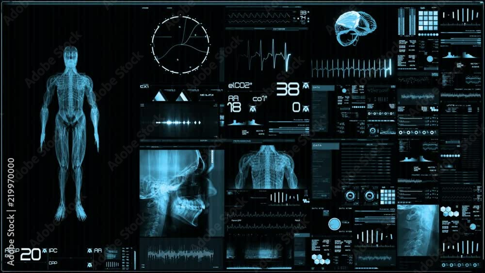 Wall mural blue futuristic patient monitor screen in perspective / medical screen interface. screen with variou