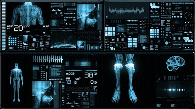 Blue futuristic patient monitor screen in perspective / Medical screen interface. Screen with various parameters measured. ST-segment and heart attack detection, pace-maker analysis, and arrhythmia an