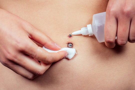 close-up hand holds cotton wool and disinfected antiseptic a drop on navel piercing. care and healing piercing