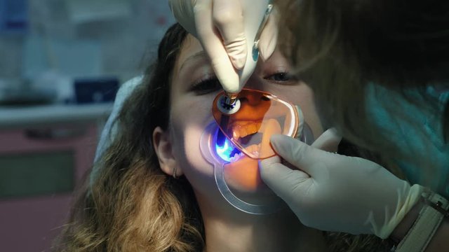Dentist assistant shines with a polymerization UV lamp on the patient's teeth. Visit to the stomatologist