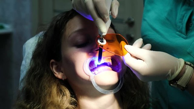 Dentist assistant shines with a dental polymerization ultraviolet lamp on the patients teeth. Visit to the stomatologist