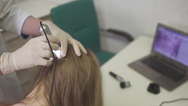 Dermatologist examines the skin on the head of the girl
