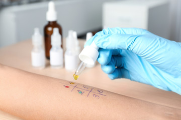 Doctor making allergy test at table, closeup
