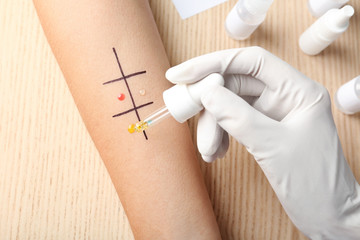 Doctor making allergy test at table, top view