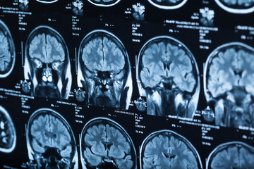 The X-ray of the human brain