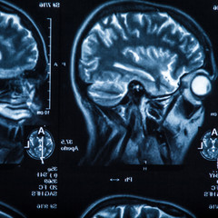 The X-ray of the human brain