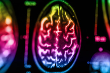 The X-ray of the human brain