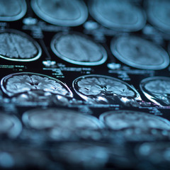 The X-ray of the human brain