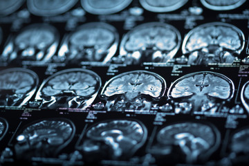 The X-ray of the human brain
