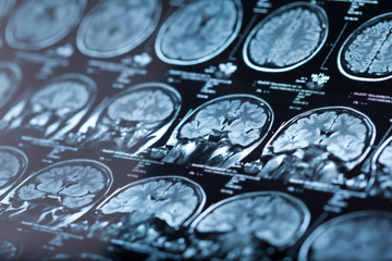 The X-ray of the human brain