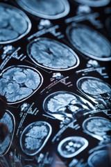 The X-ray of the human brain