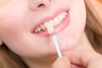 Naklejka premium Farbe für Zahnersatz wird am Mund einer Patientin abgeglichen