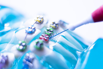 Interdental teeth brackets clean