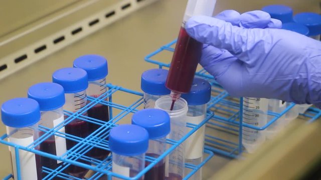 Transferring Whole Blood to a Conical Centrifuge Tube Under a Steril Hood in a Lab - PRP and Stem Cell Process - Close Up