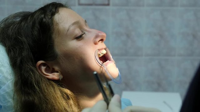 Visit to the dentist, installation of the bracket system. Assistant shines with a dental polymerization ultraviolet lamp on the braces to the patient close-up.