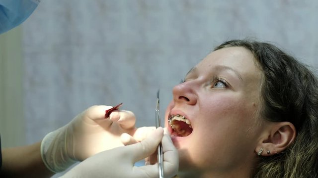 Visit to the dentist. Orthodontist removes the tracing-paper from the patient's mouth