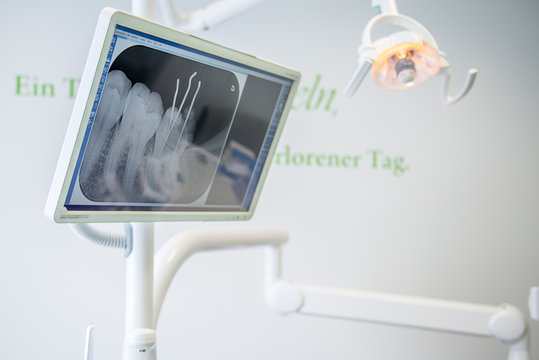 Zahnarzt Ausstattung Röntgen Bild