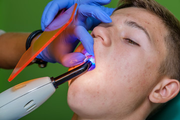 Attaching brackets on the teenager's teeth with a special UV glue.