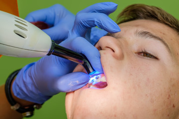 The doctor's hands attaching brackets on the teeth of young boy