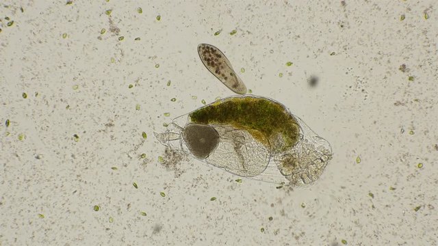 rotifer filters water, and around it I swim the alga Dunaliella salina, under a microscope