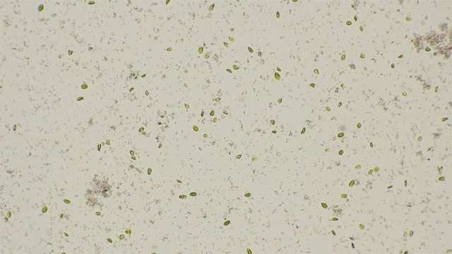 algae Dunaliella saline and the bacteria Archaea, which dye water in pink, under a microscope